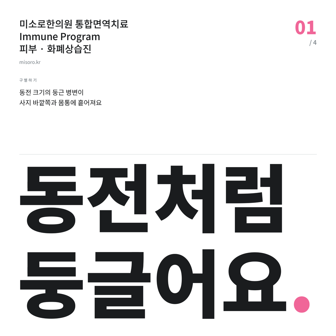 화폐상습진 동전처럼 둥글어요