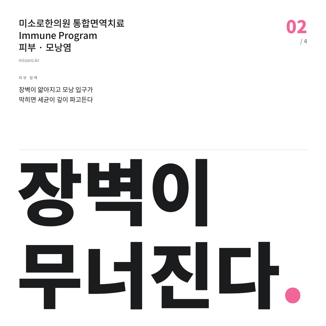 아산 모낭염 장벽이 무너진다