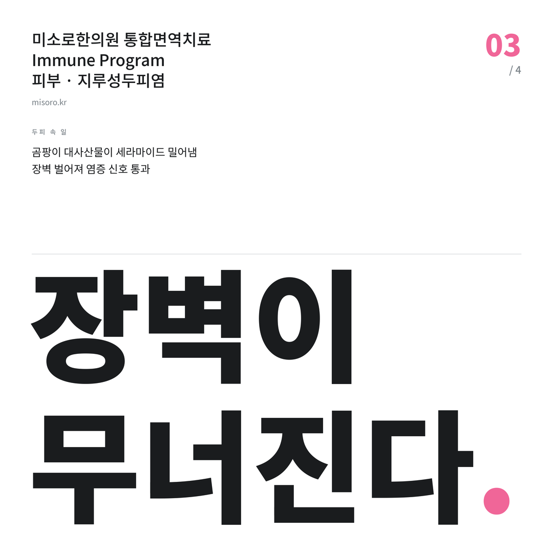 판교 지루성두피염 장벽이 무너진다