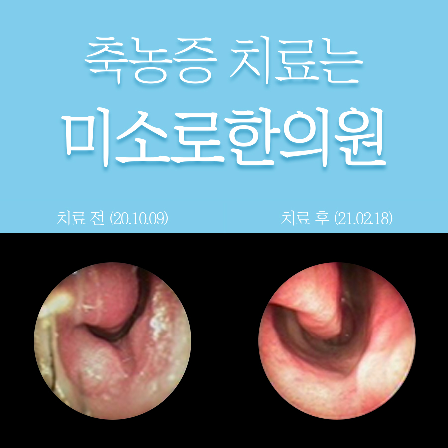분당 축농증 수술 후기 통증 관련 이미지 1
