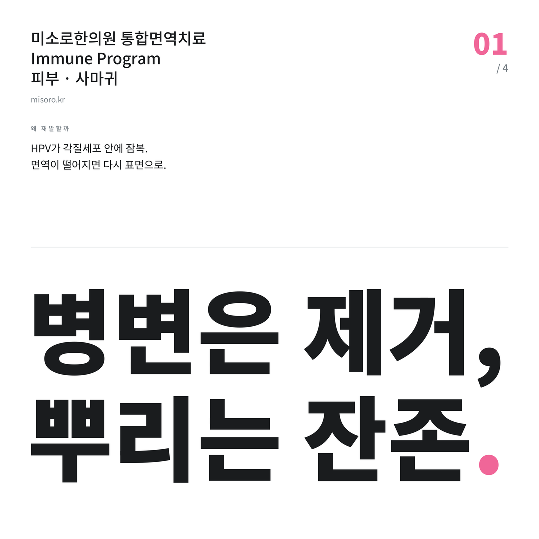 안중 사마귀 병변은 제거, 뿌리는 잔존