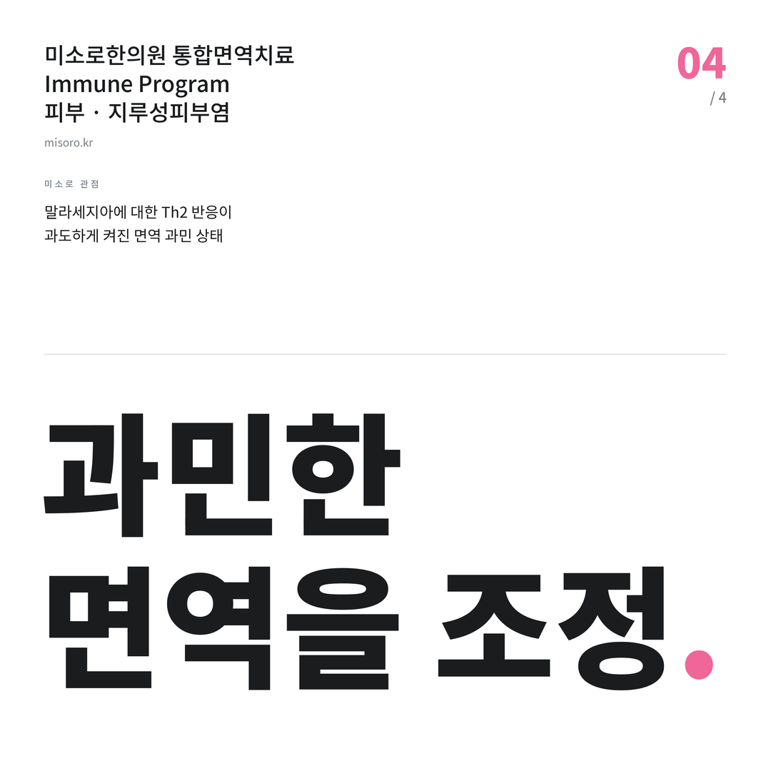지루성피부염 과민한 면역을 조정