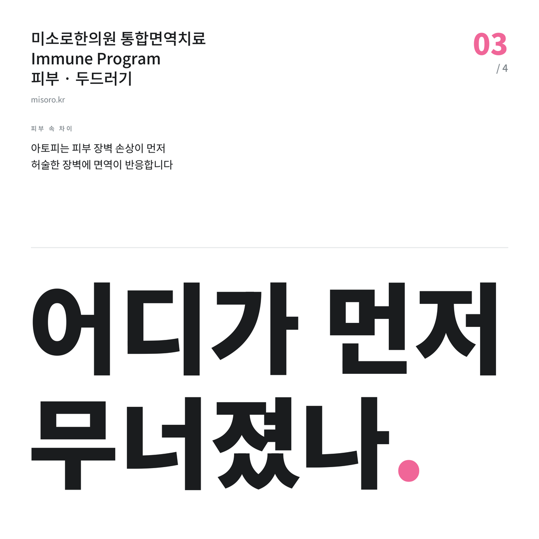 성정동 두드러기 어디가 먼저 무너졌나