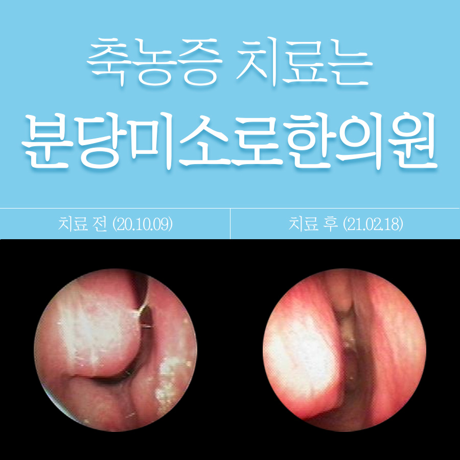 경기광주 축농증 치료 한의원 관련 이미지 1