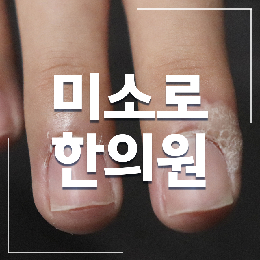 성남 편평사마귀면역치료 병원 관련 이미지 1