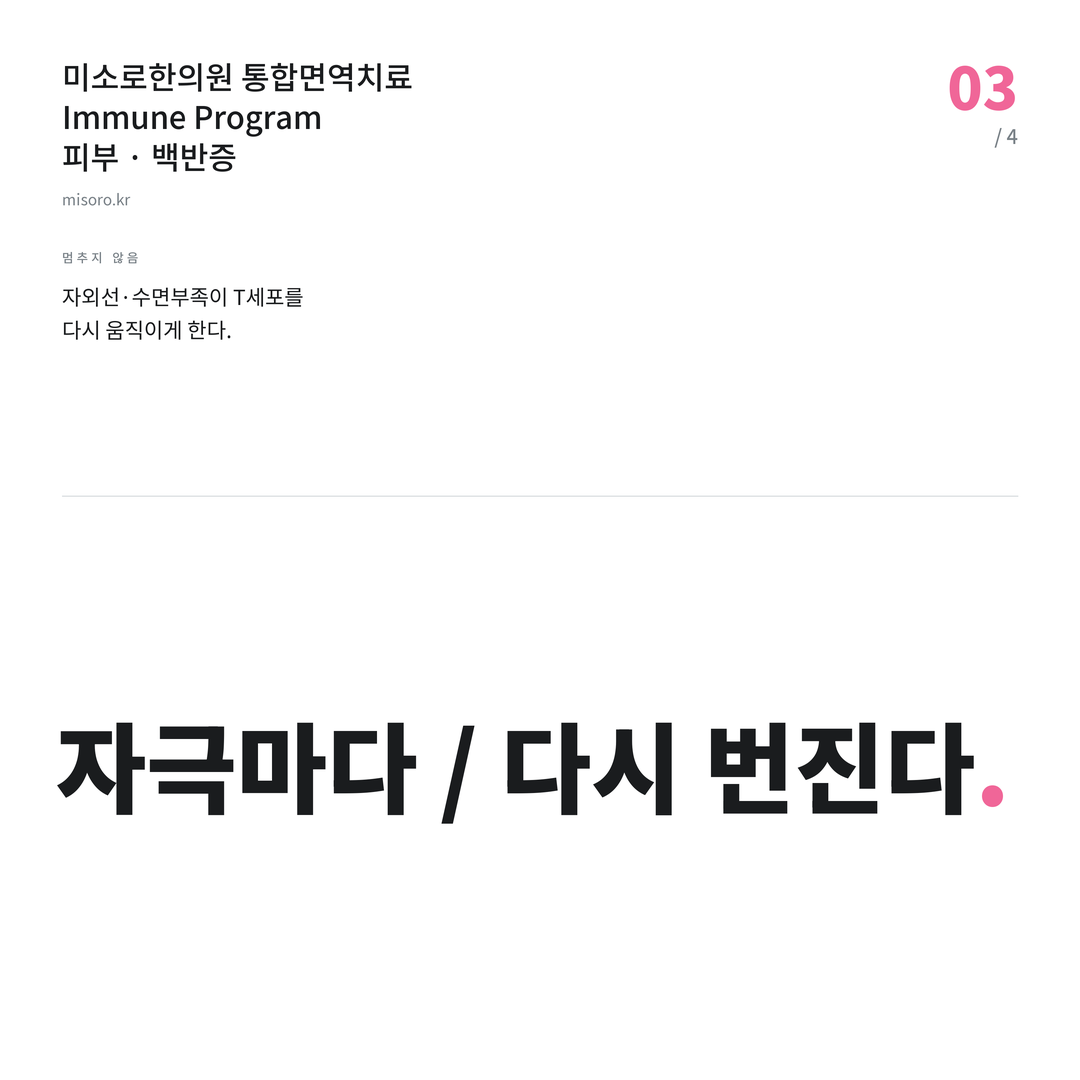 병점 백반증 자극마다 / 다시 번진다