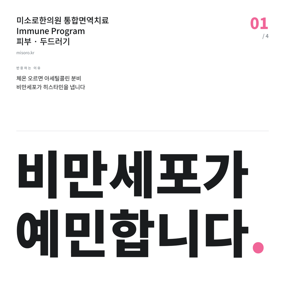 화곡 두드러기 비만세포가 예민합니다