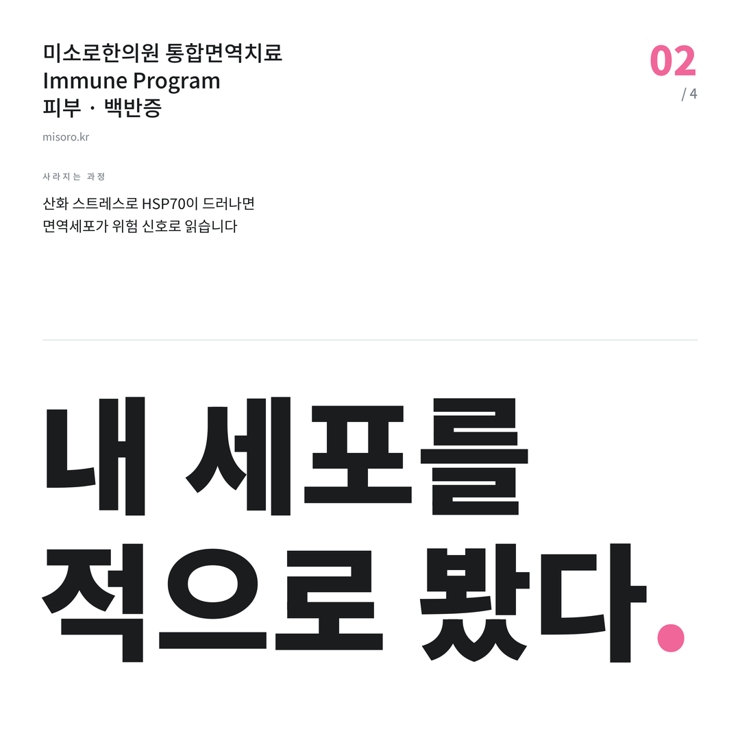 인천 백반증 내 세포를 적으로 봤다