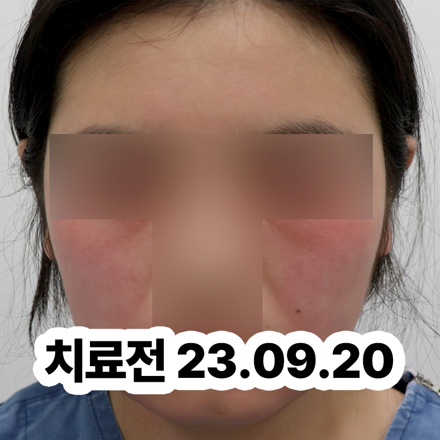 분당 습진 피부과 관련 이미지 2