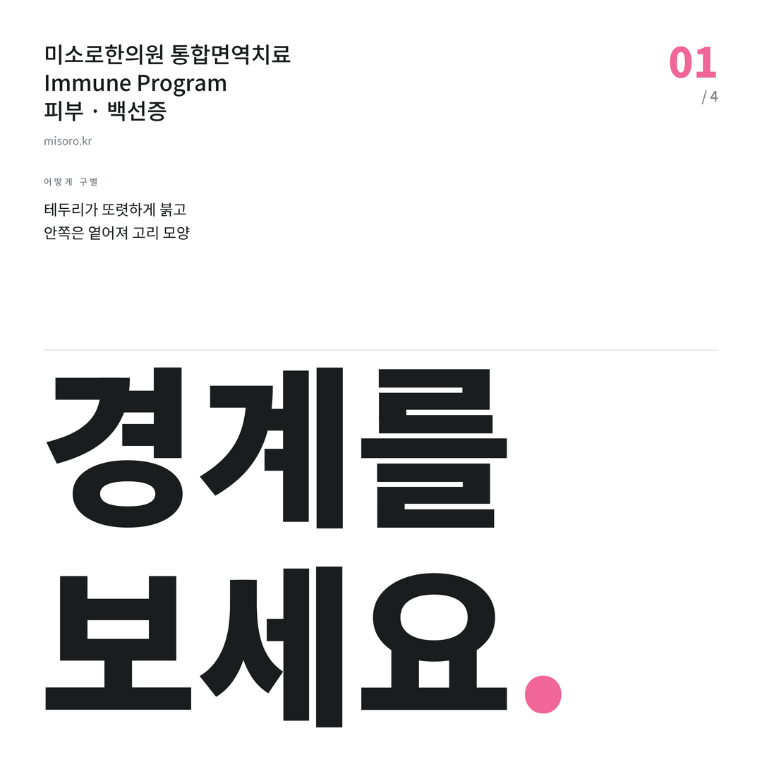 정읍 백선증 경계를 보세요