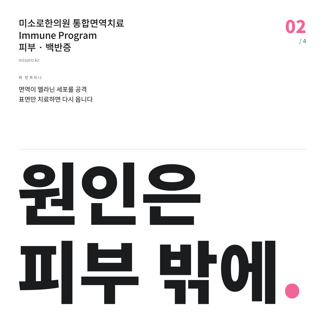 신부동 백반증 원인은 피부 밖에