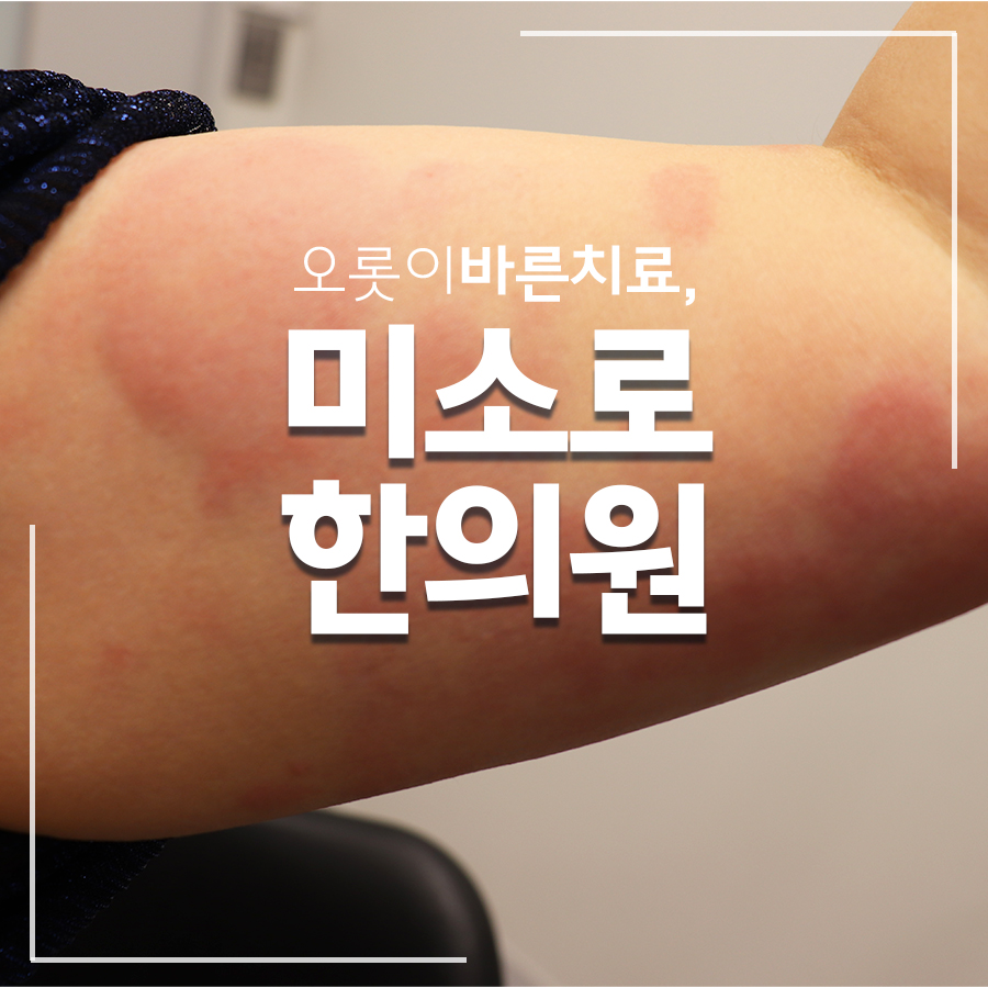 성남 근처 묘기증 한의원 관련 이미지 1