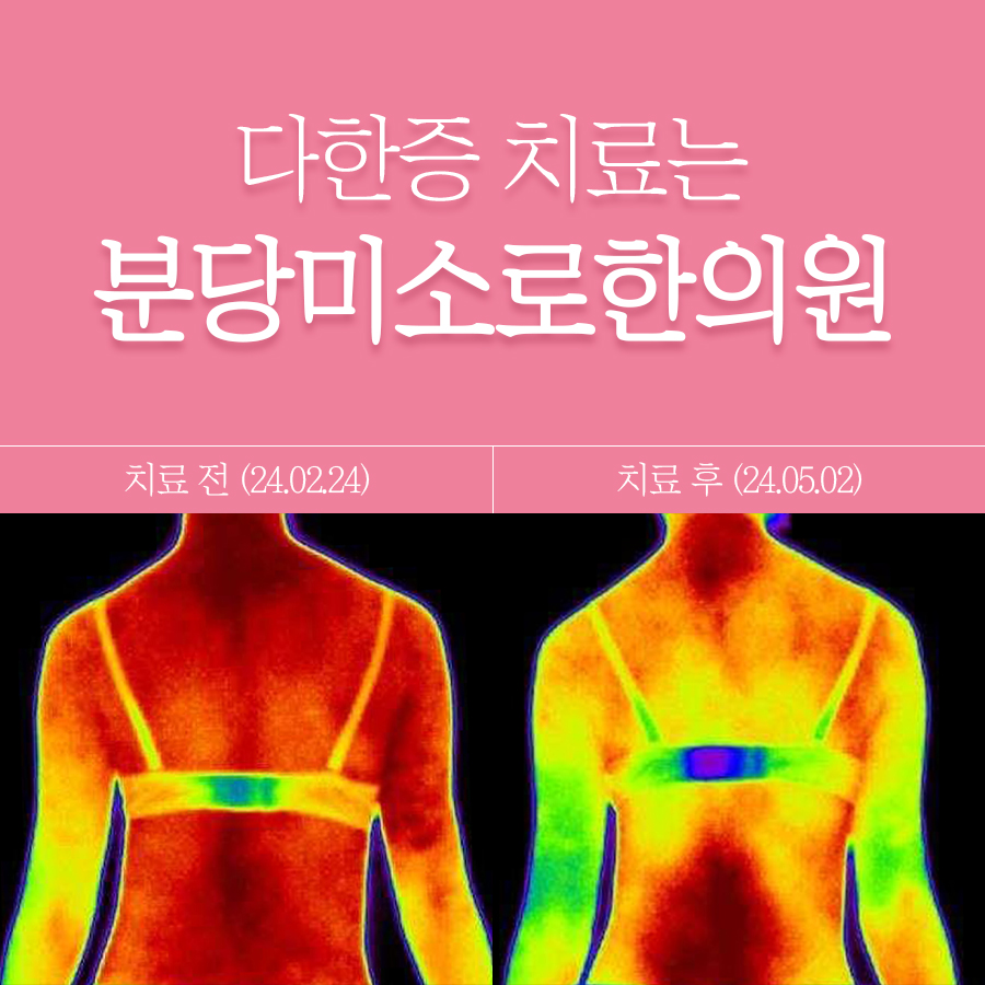 판교 미각다한증치료 관련 이미지 1