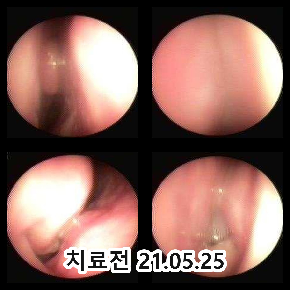 인계동 한방비염약제 관련 이미지 2