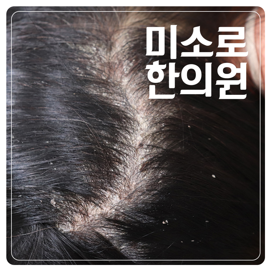 여주 피부 건선 병원 추천 관련 이미지 1