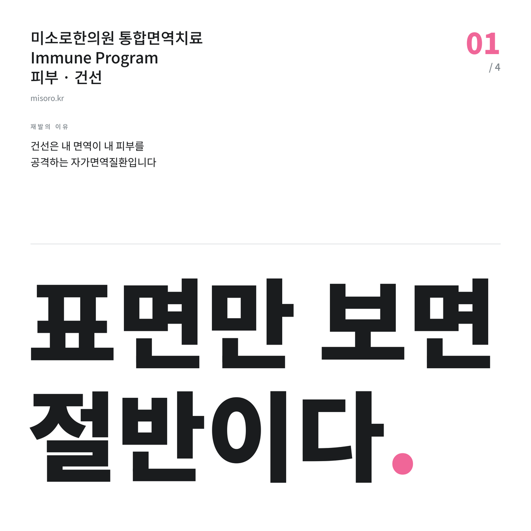 익산 건선 표면만 보면 절반이다