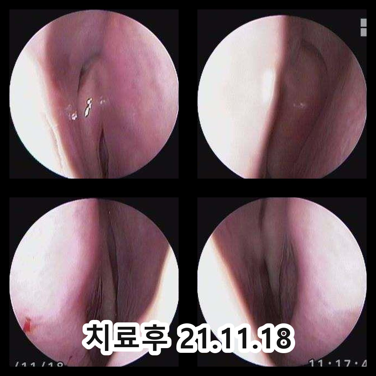 여주 어린이비염한의원 관련 이미지 3