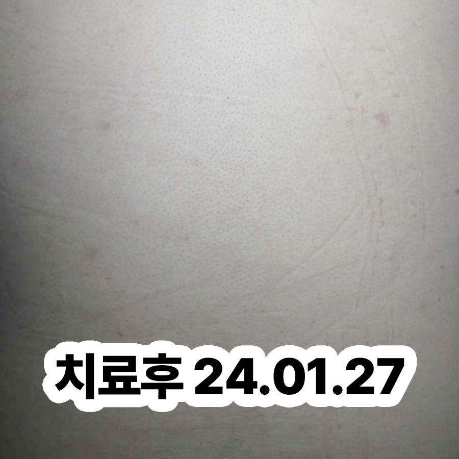 위례 피부묘기증 한의원 관련 이미지 3