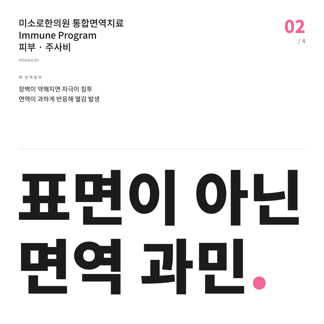 화곡 주사비 표면이 아닌 면역 과민