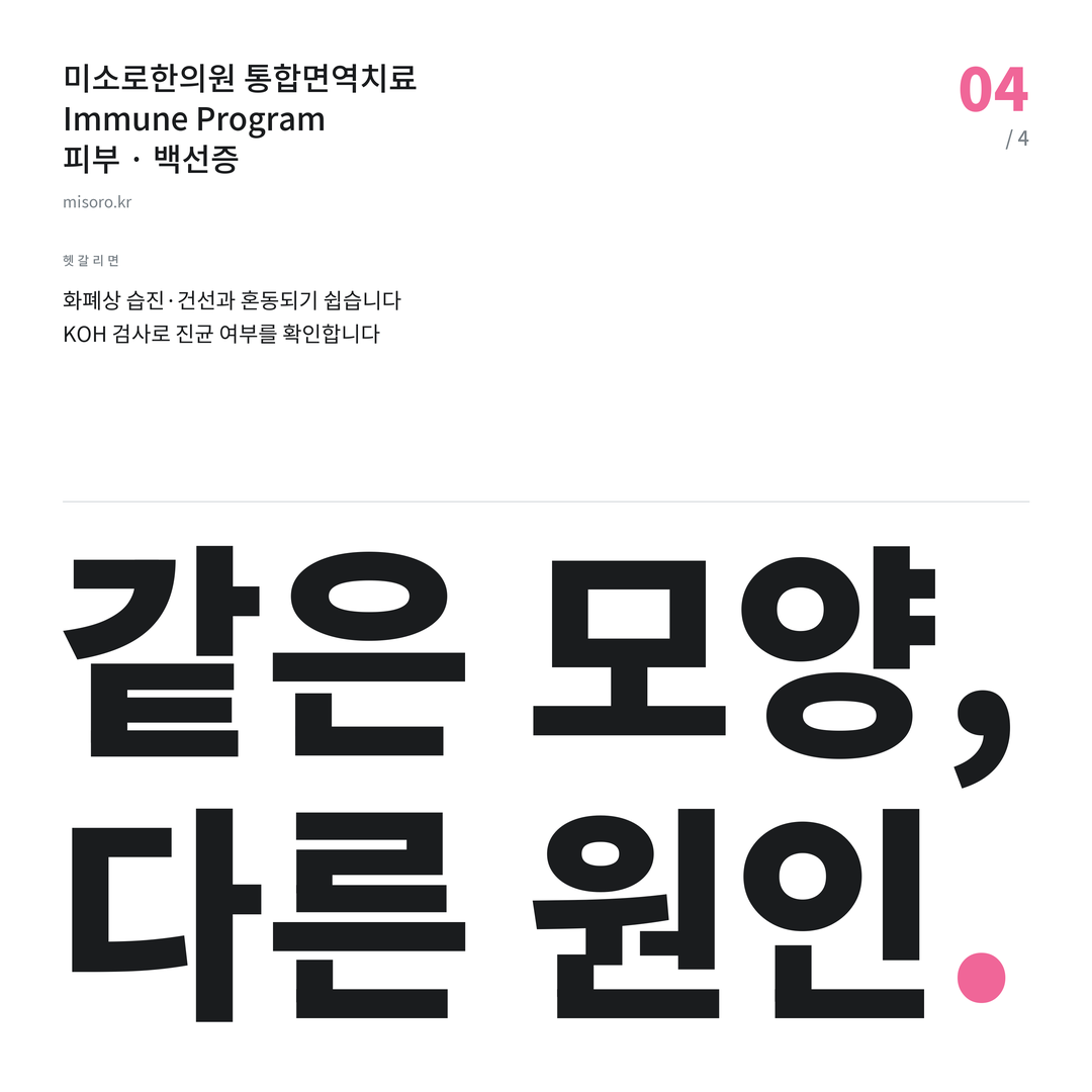 안중 백선증 같은 모양, 다른 원인