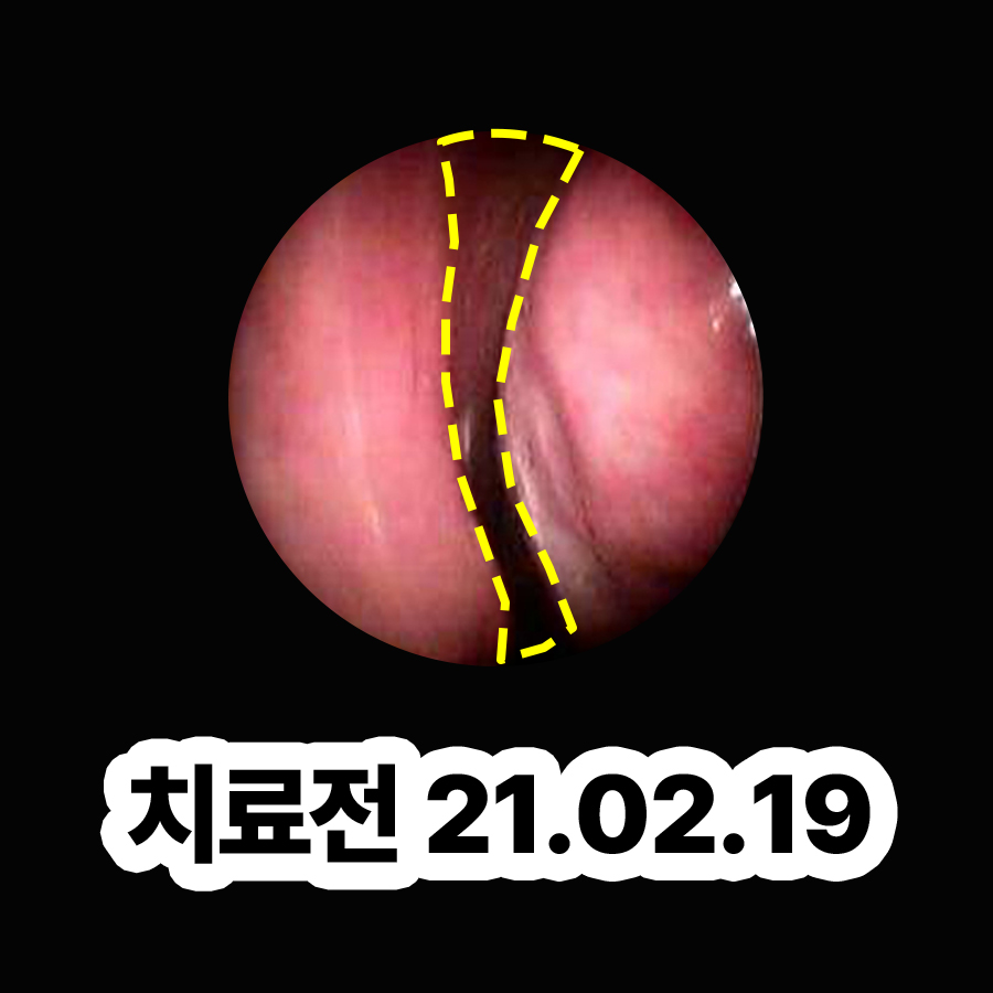 분당알레르기성비염한의원 관련 이미지 2