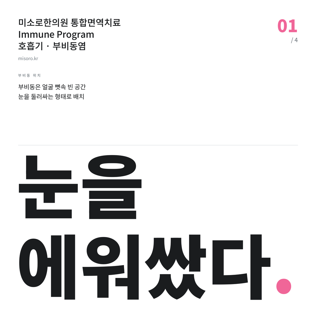 유성 부비동염 눈을 에워쌌다