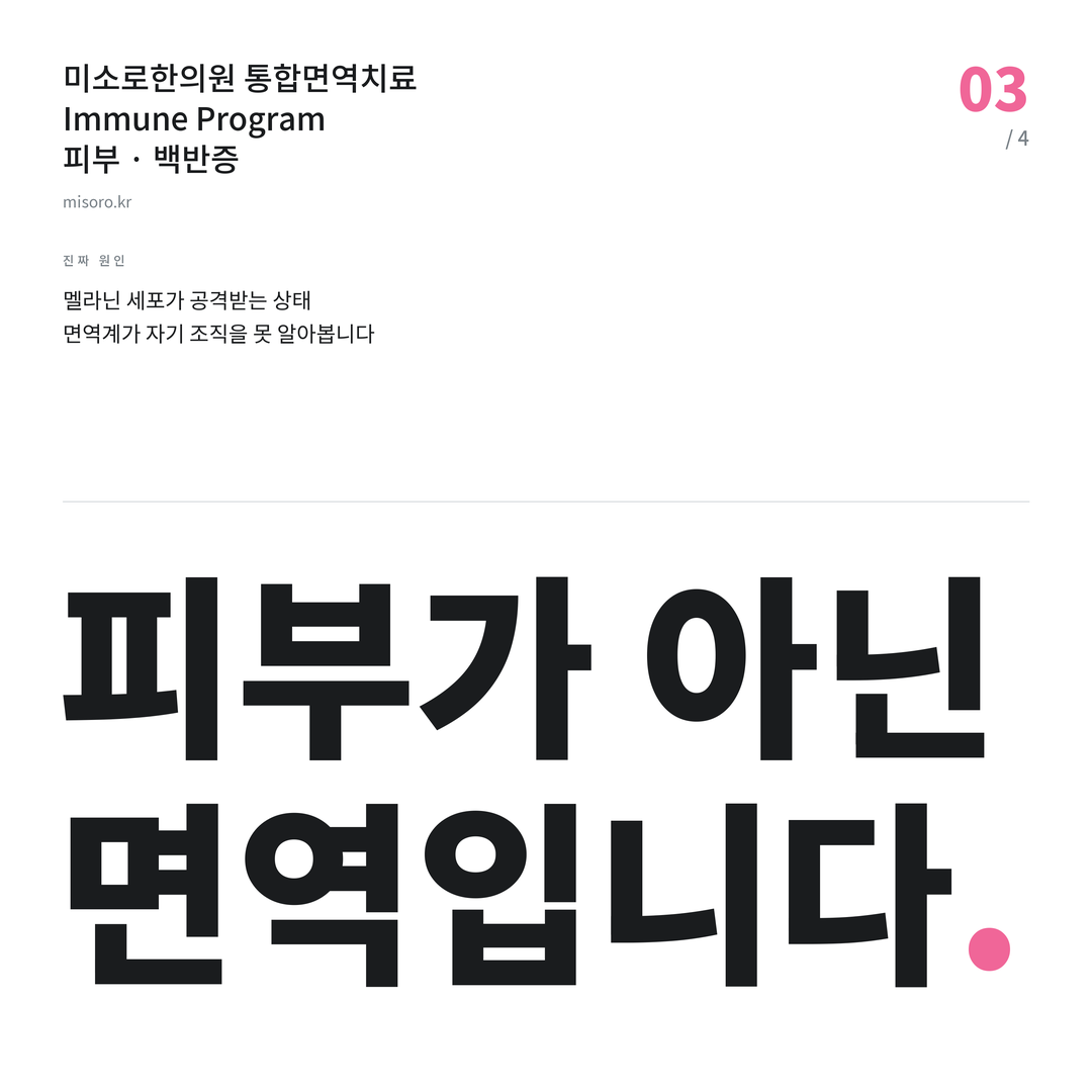은행동 백반증 피부가 아닌 면역입니다