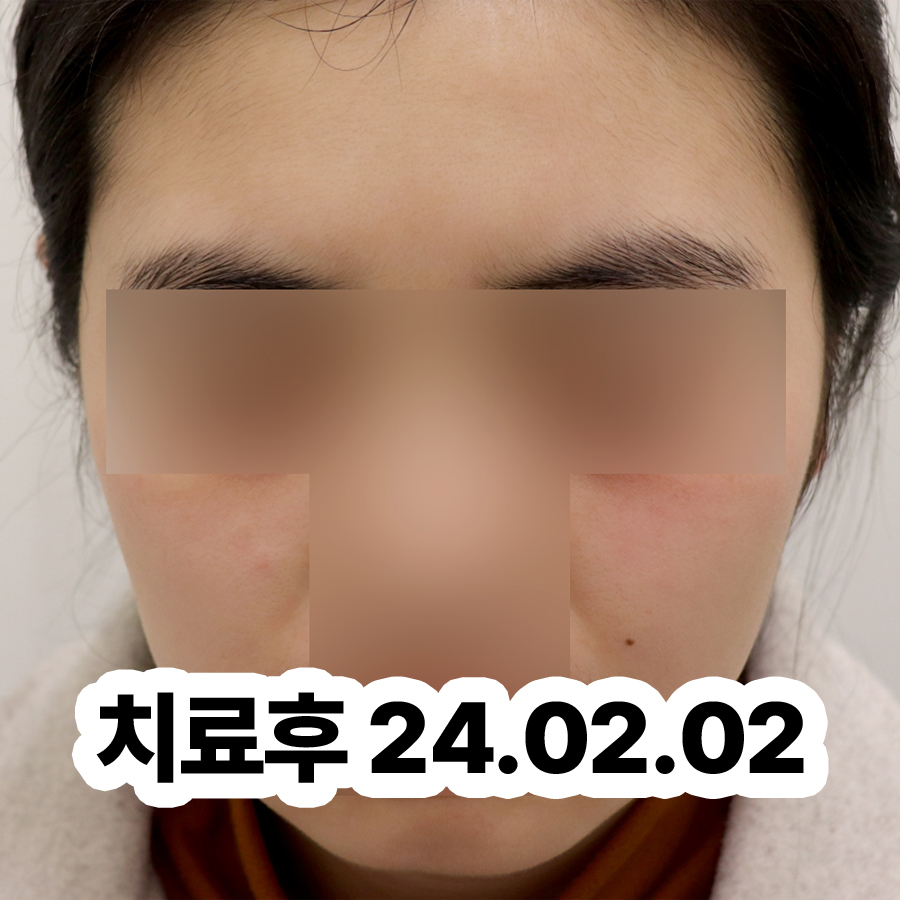 분당 습진 피부과 관련 이미지 3
