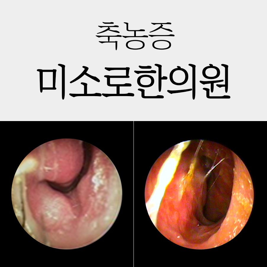 분당 축농증 이비인후과 관련 이미지 1