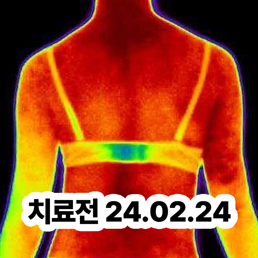 분당 다한증 병원 관련 이미지 2