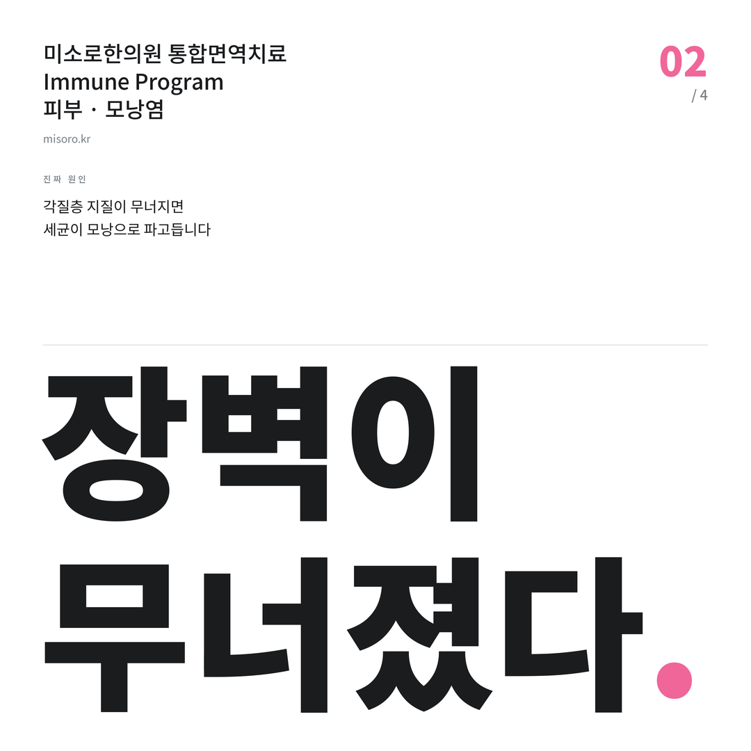 모낭염 장벽이 무너졌다
