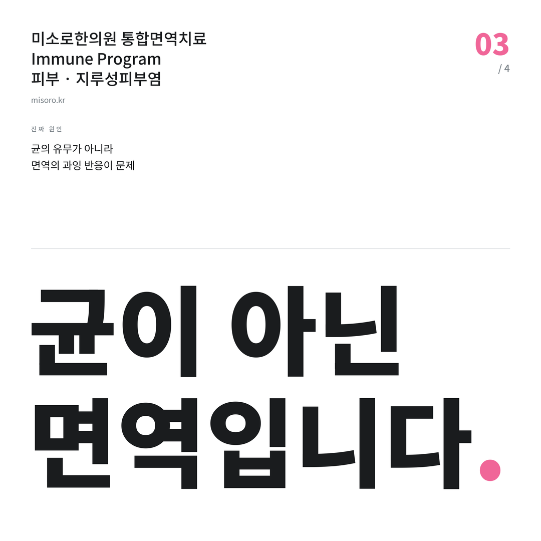 시흥 지루성피부염 균이 아닌 면역입니다