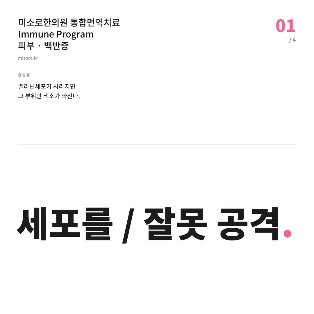 병점 백반증 세포를 / 잘못 공격
