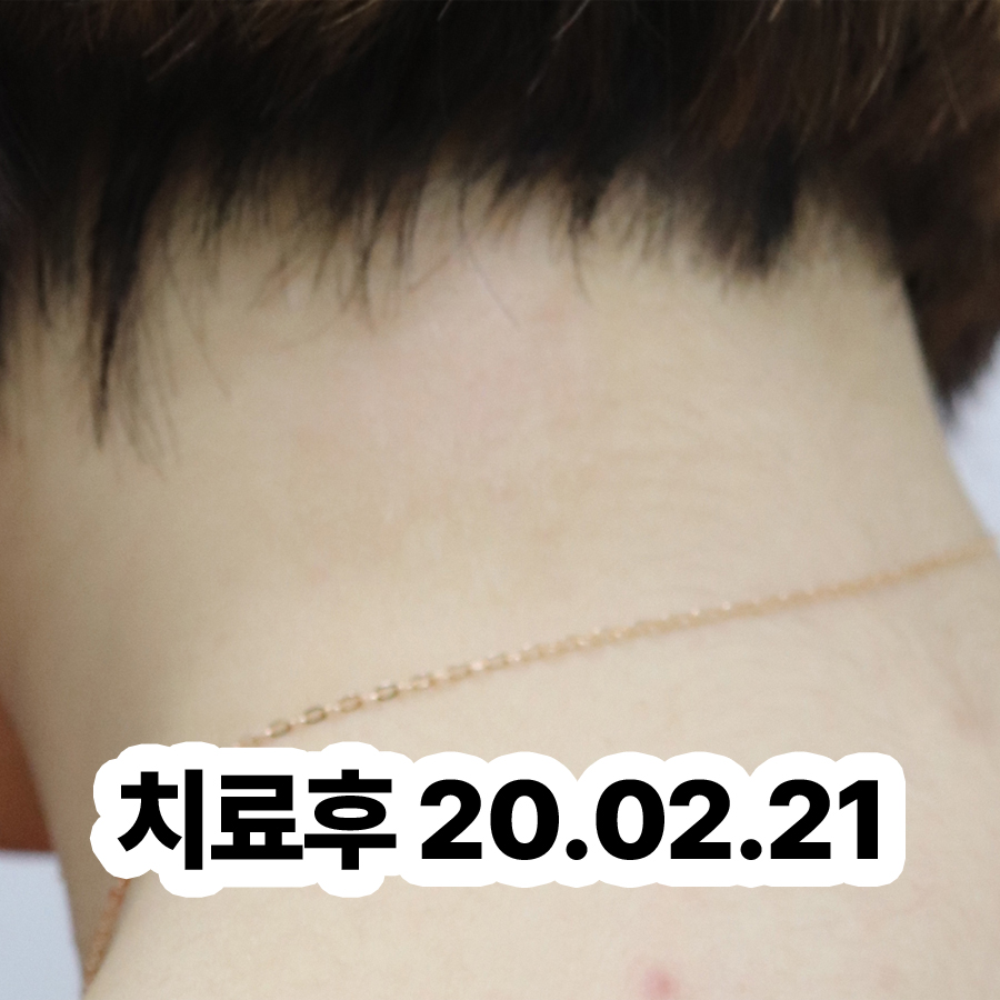 분당 성인 아토피 한의원 추천 관련 이미지 3