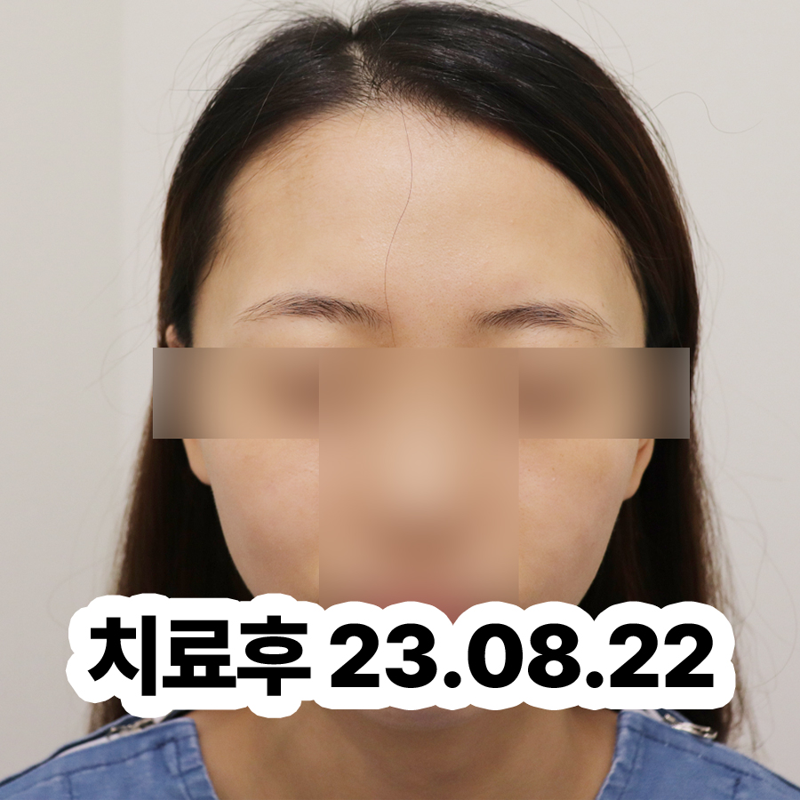 분당 성인아토피치료방법 관련 이미지 3