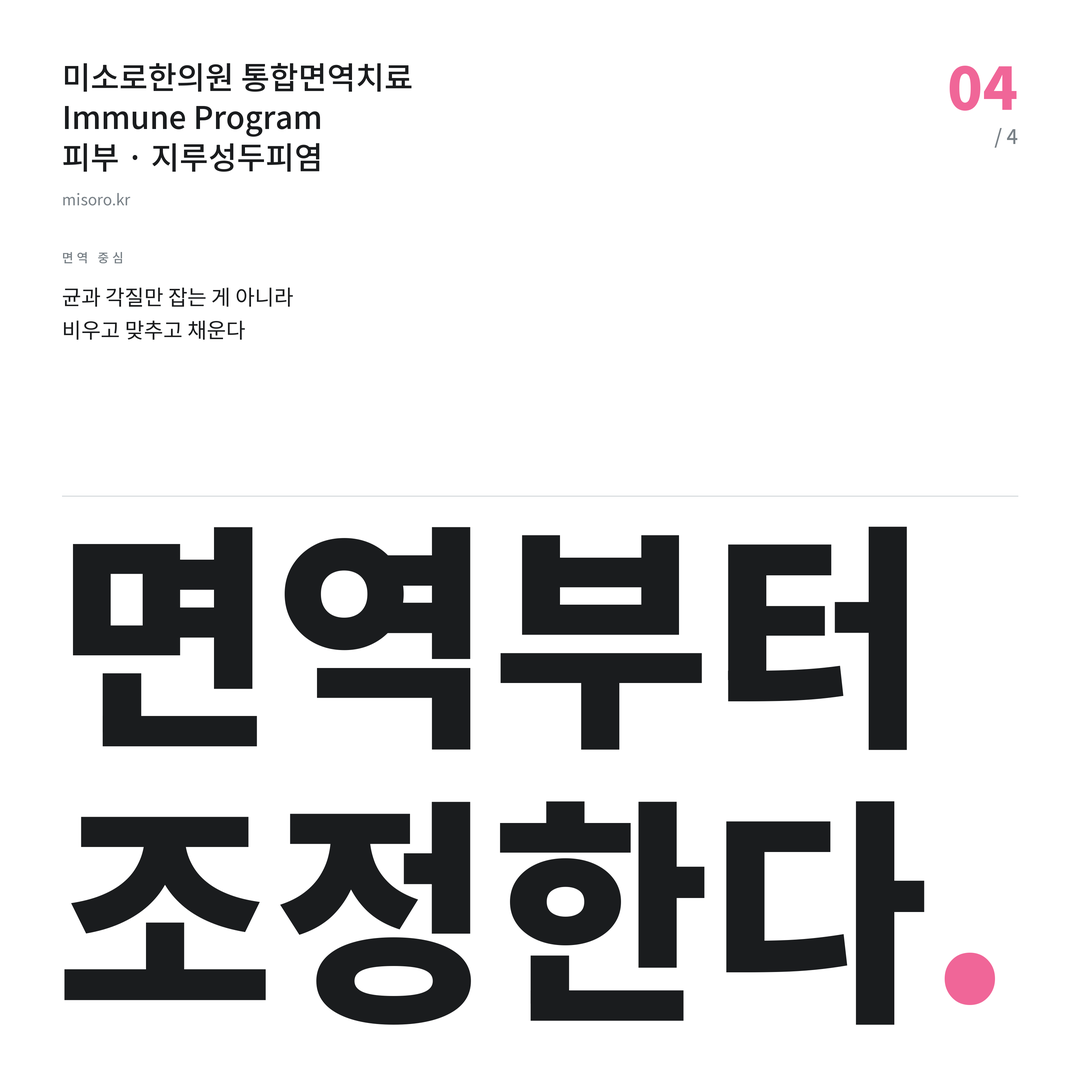 성정동 지루성두피염 면역부터 조정한다