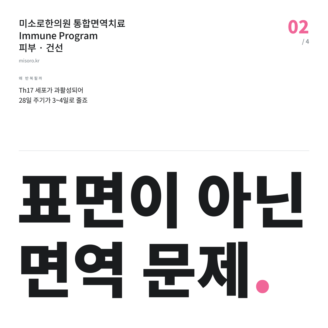 목동 건선 표면이 아닌 면역 문제