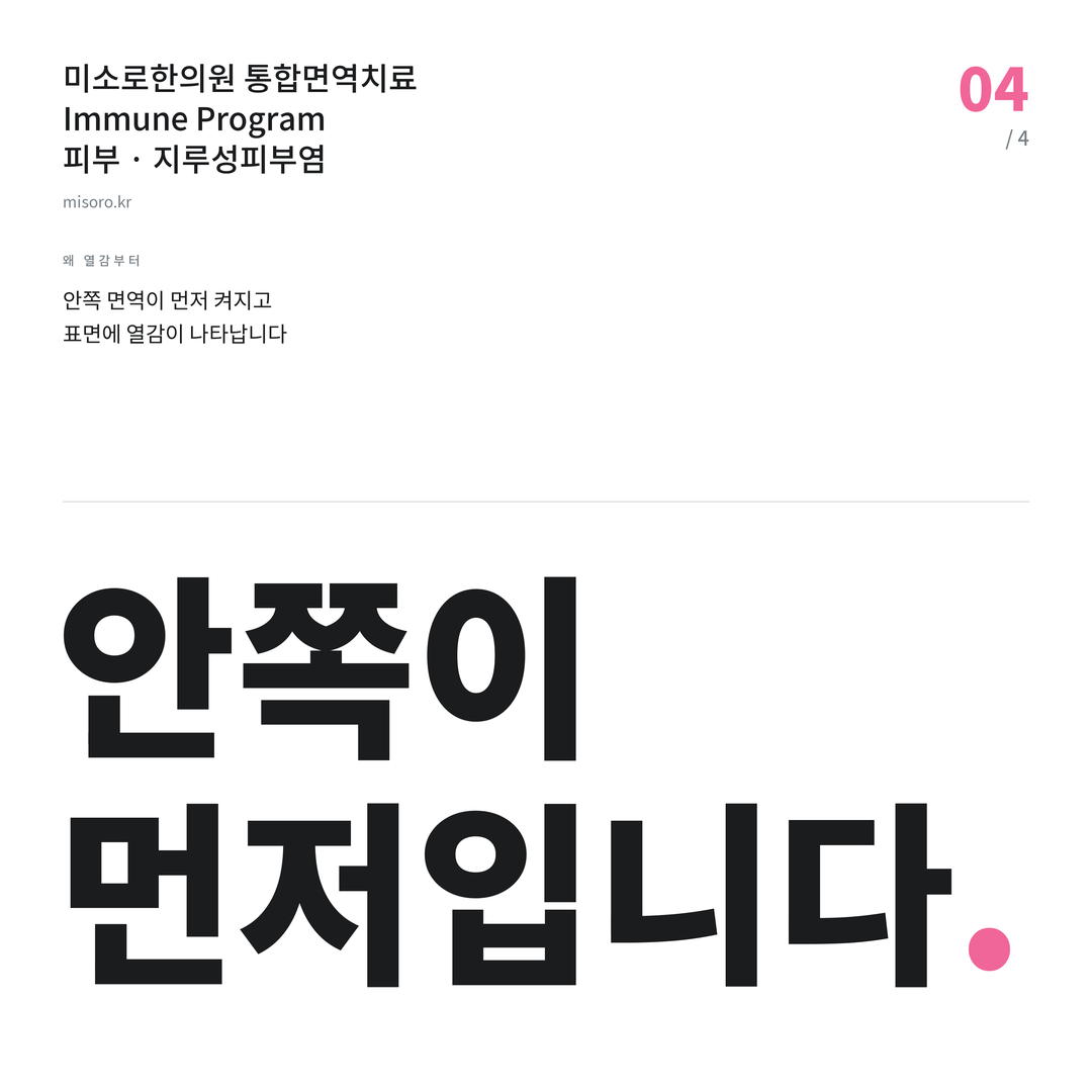 고덕 지루성피부염 안쪽이 먼저입니다