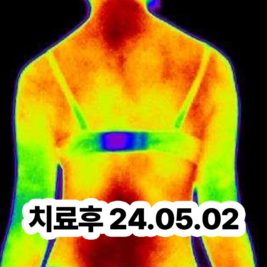 분당 다한증 병원 관련 이미지 3