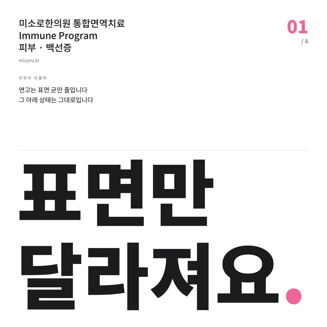 백선증 표면만 달라져요