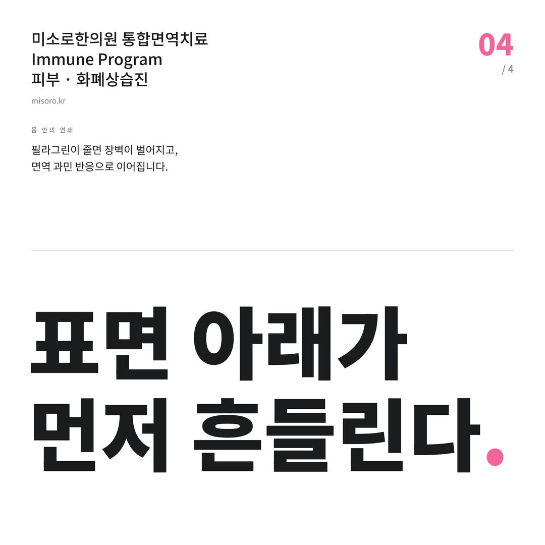 논현동 화폐상습진 표면 아래가 먼저 흔들린다