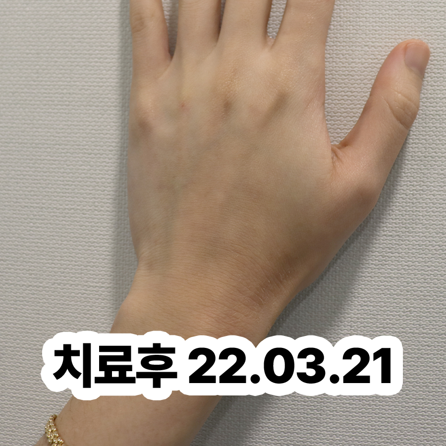 경기광주 발한포진연고 관련 이미지 3