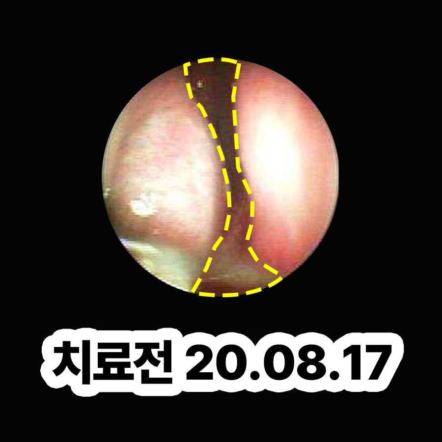 위례 축농증치료한의원 관련 이미지 2