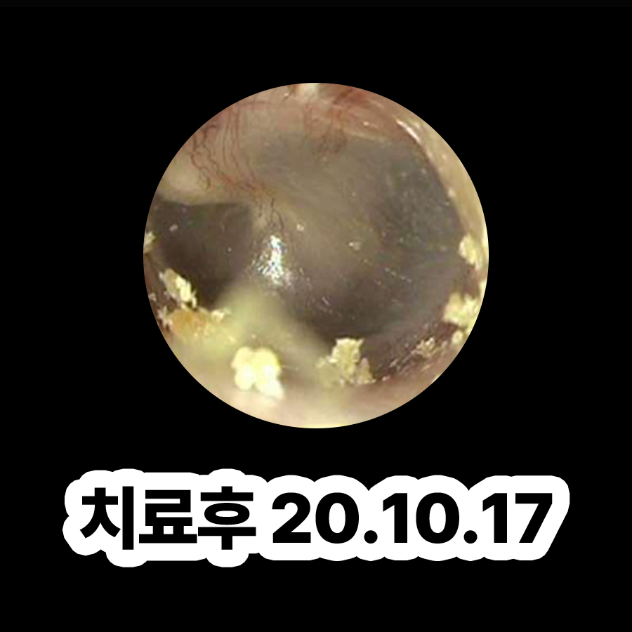 분당 중이염 병원 관련 이미지 3