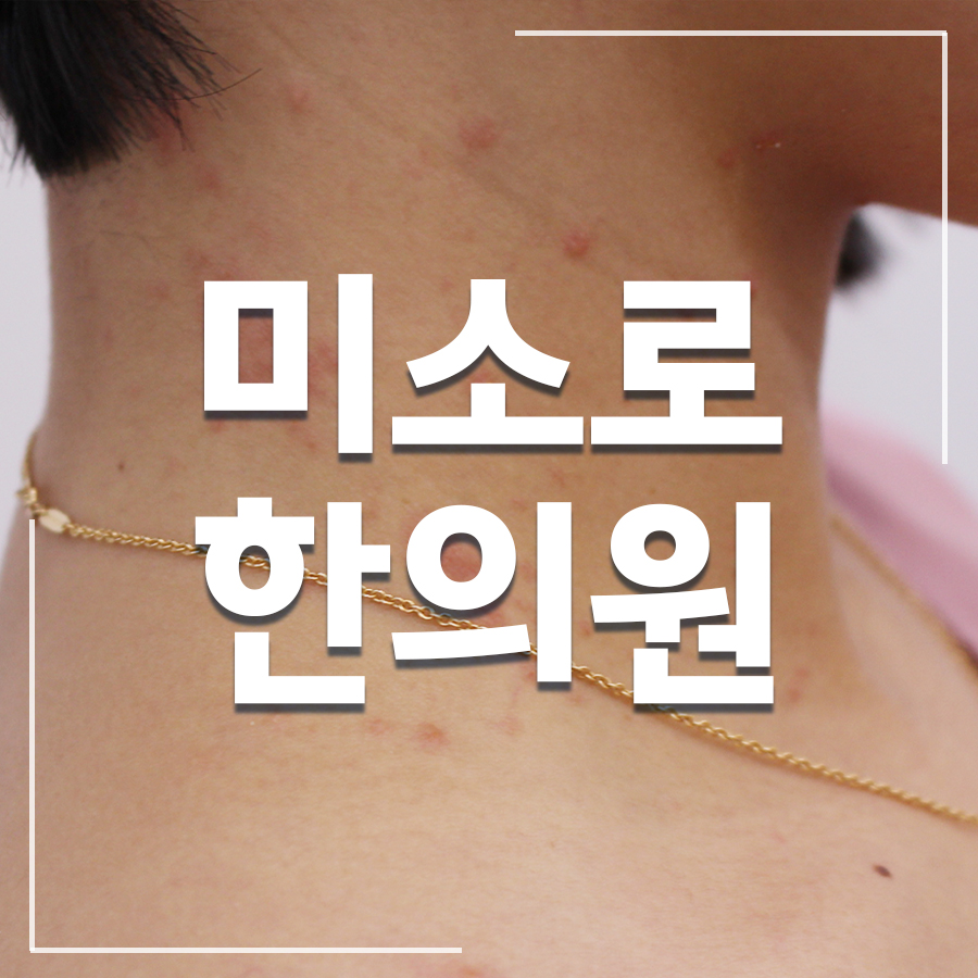 시흥 습진 가려움 완화 관련 이미지 1
