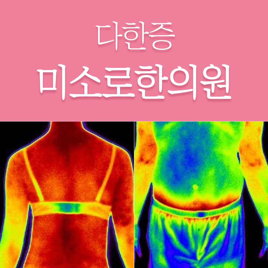 위례 수족다한증 수술 후기 관련 이미지 1