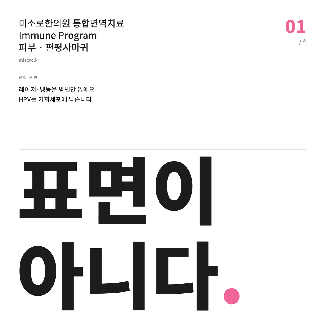 이천 편평사마귀 표면이 아니다