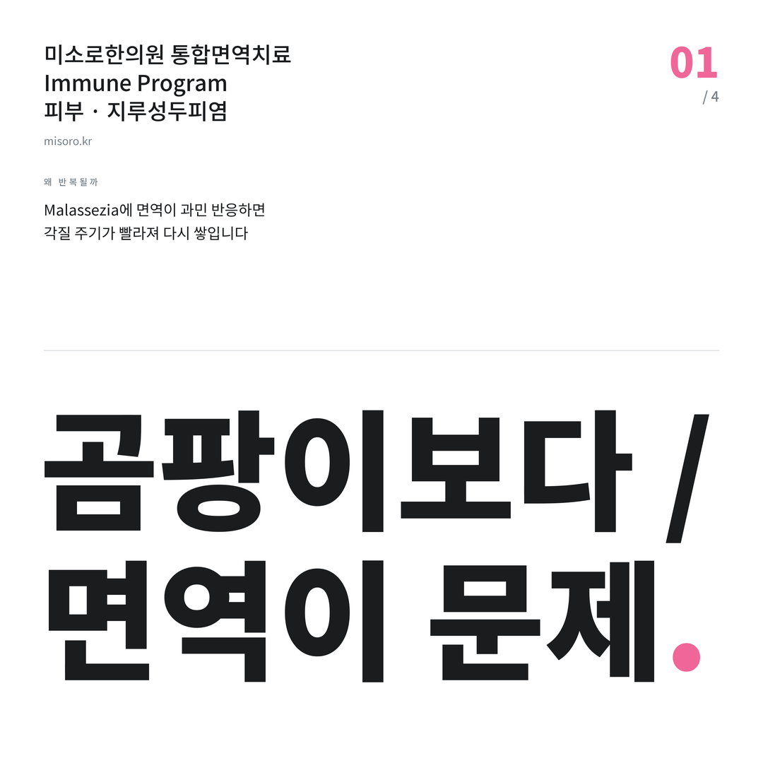 양평동 지루성두피염 곰팡이보다 / 면역이 문제