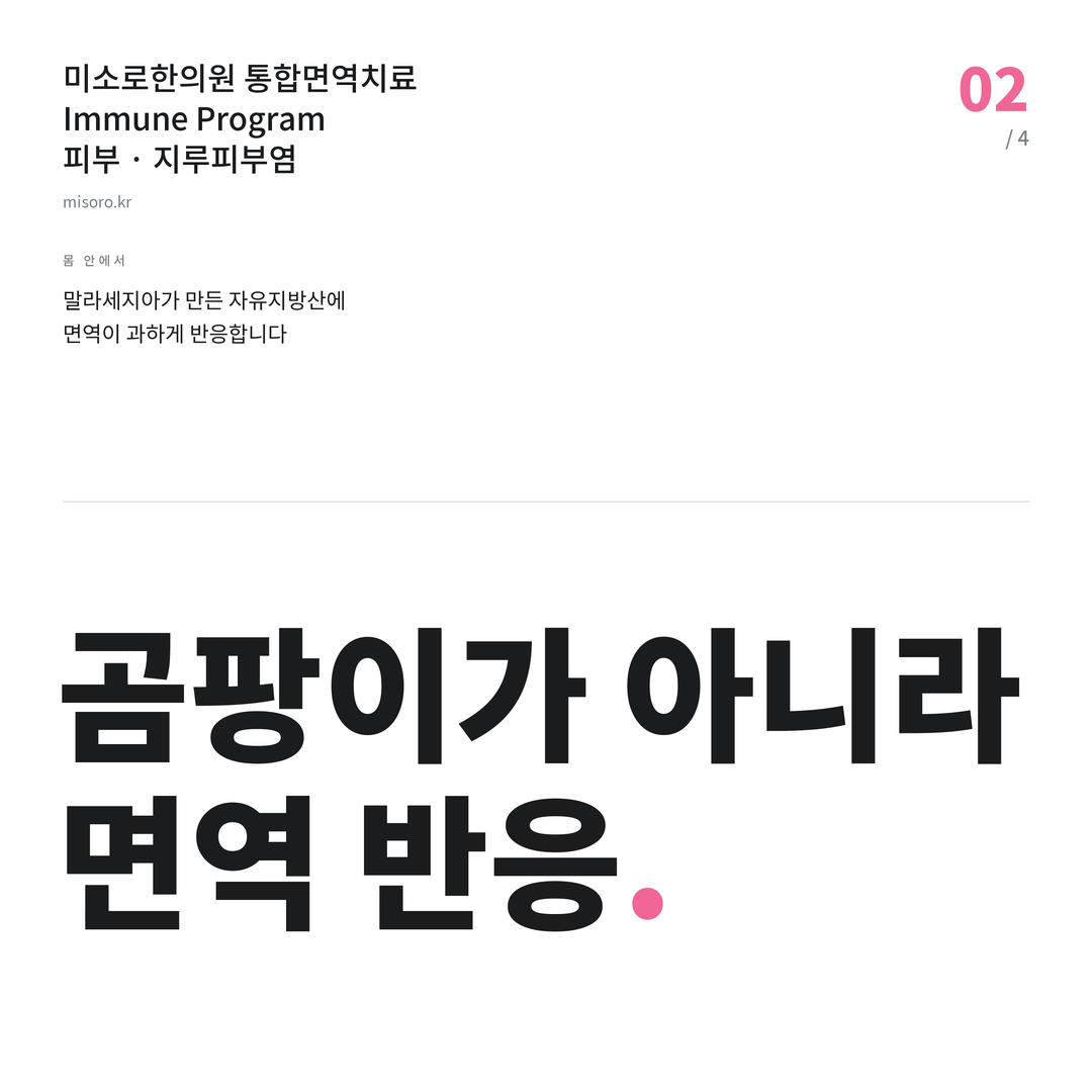 아산 지루피부염 곰팡이가 아니라 면역 반응