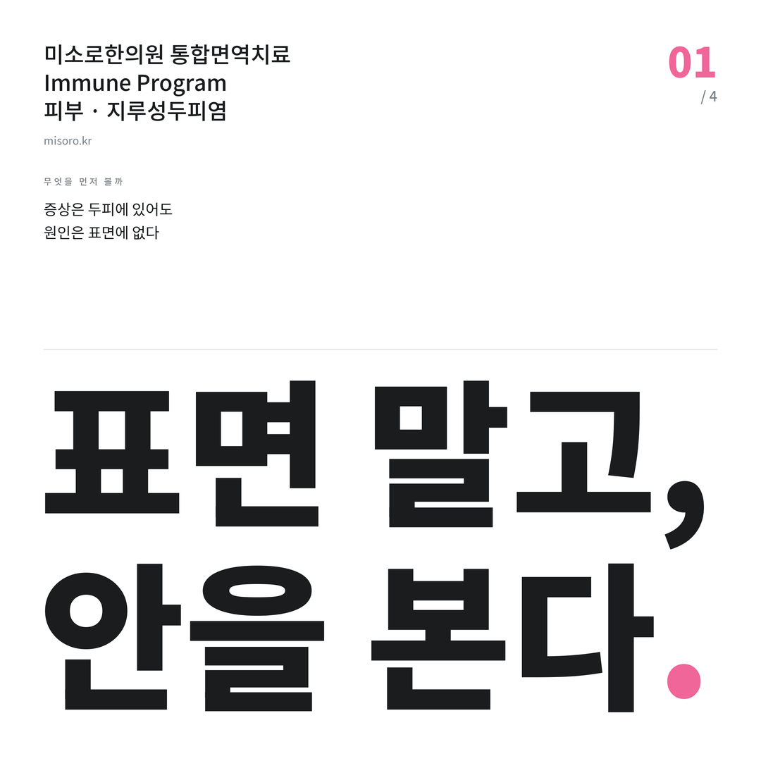 성정동 지루성두피염 표면 말고, 안을 본다